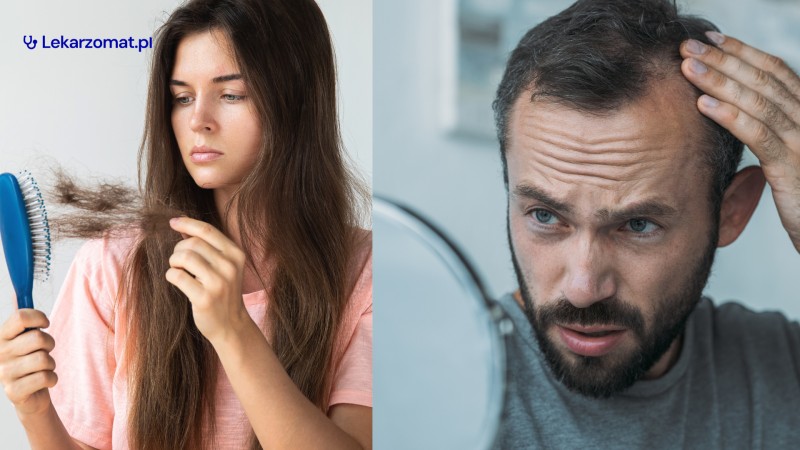 Wypadanie w�os�w - przyczyny, leczenie i&nbsp;skuteczne sposoby